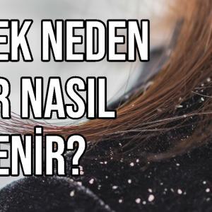 Kepek Neden Olur Nasıl Önlenir