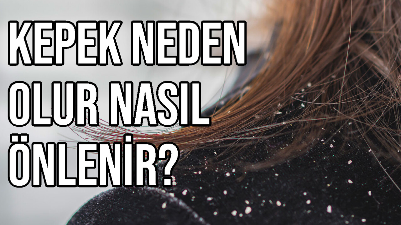 Kepek Neden Olur Nasıl Önlenir