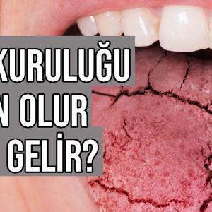 ağız kuruluğu neden olur ne iyi gelir